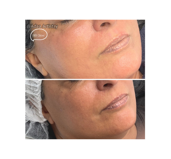Nano BB glow radiant even skin tone treatment