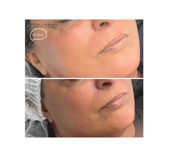 Nano BB glow radiant even skin tone treatment