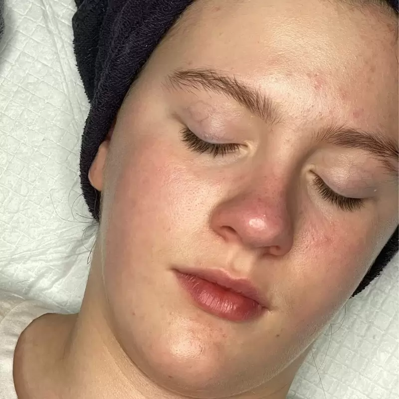 Teen facial gentle skincare clean healthy skin