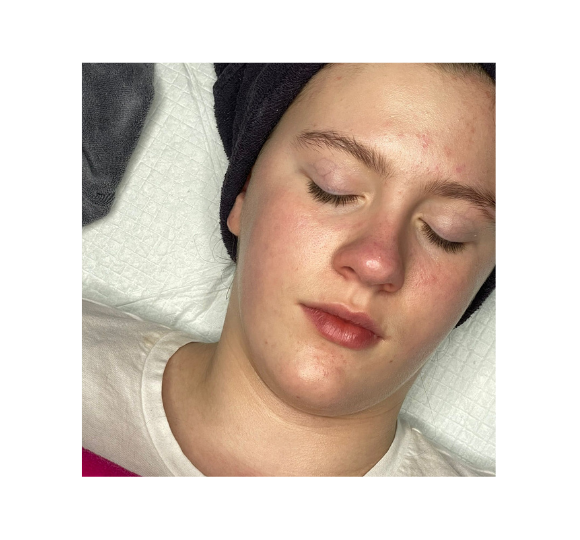 Teen facial gentle skincare clean healthy skin